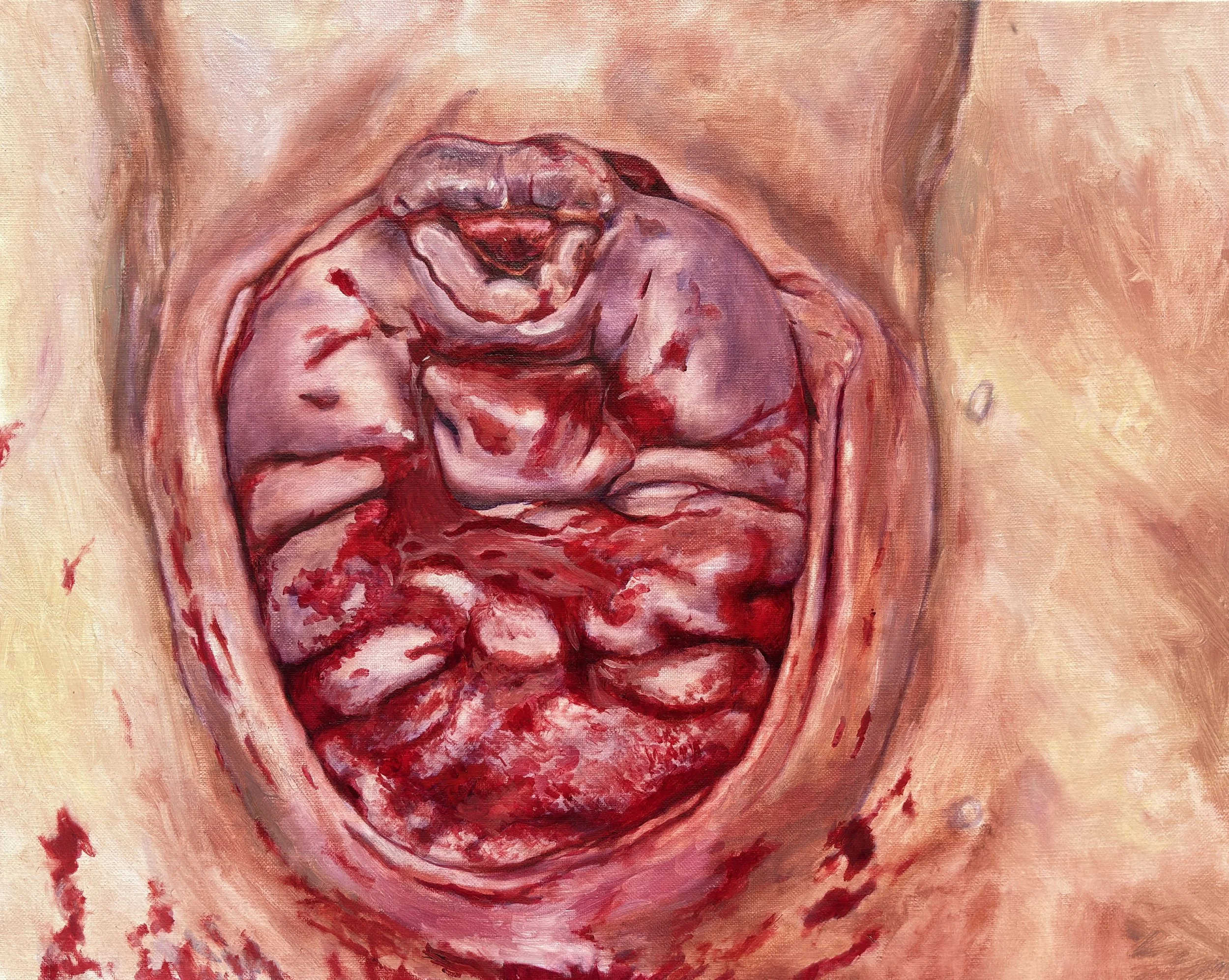 Birth II, 2026