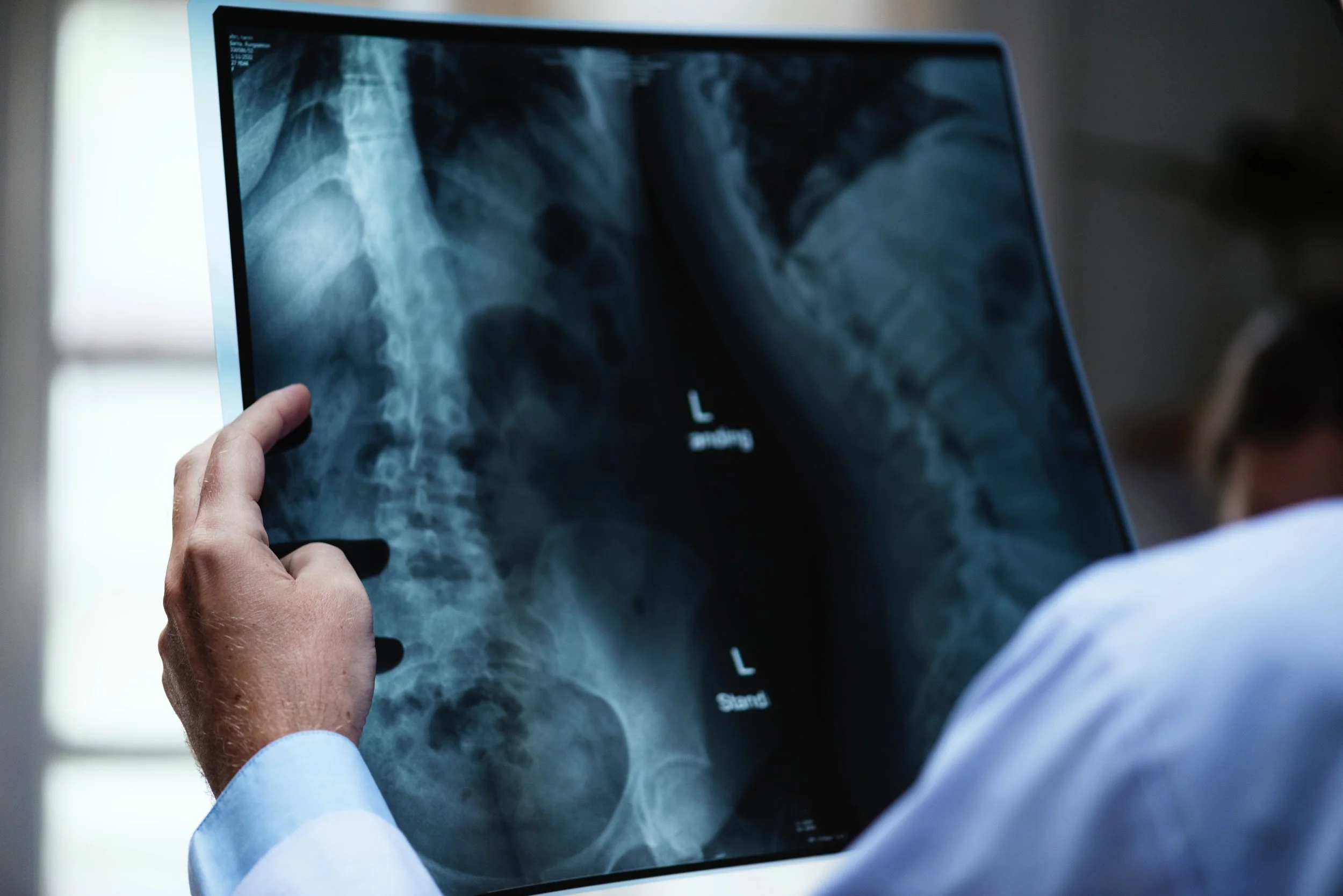 ¿Qué es la Osteopatía?