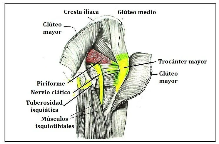 Sinndrome+piramidal.jpghttps://upload.wikimedia.org/wikipedia/commons/c/c7/Piriformis_syndrome_%281%29-es.jpg