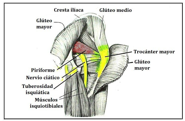 Sinndrome+piramidal.jpghttps://upload.wikimedia.org/wikipedia/commons/c/c7/Piriformis_syndrome_%281%29-es.jpg