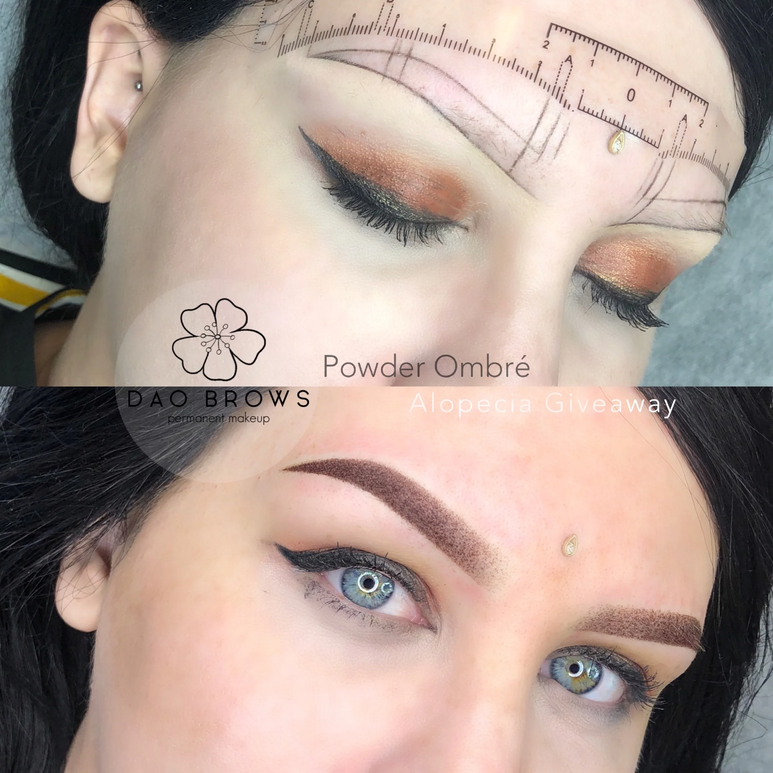 Alopecia Giveaway Recipient