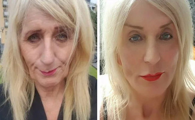 Transgender £4M Lottery Scratch Card Winner Spends £3000 On Dramatic Cosmetic Upgrade 