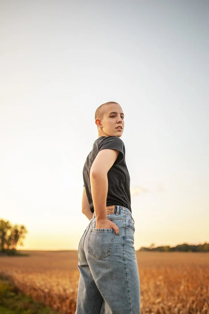 baldness_067.jpg