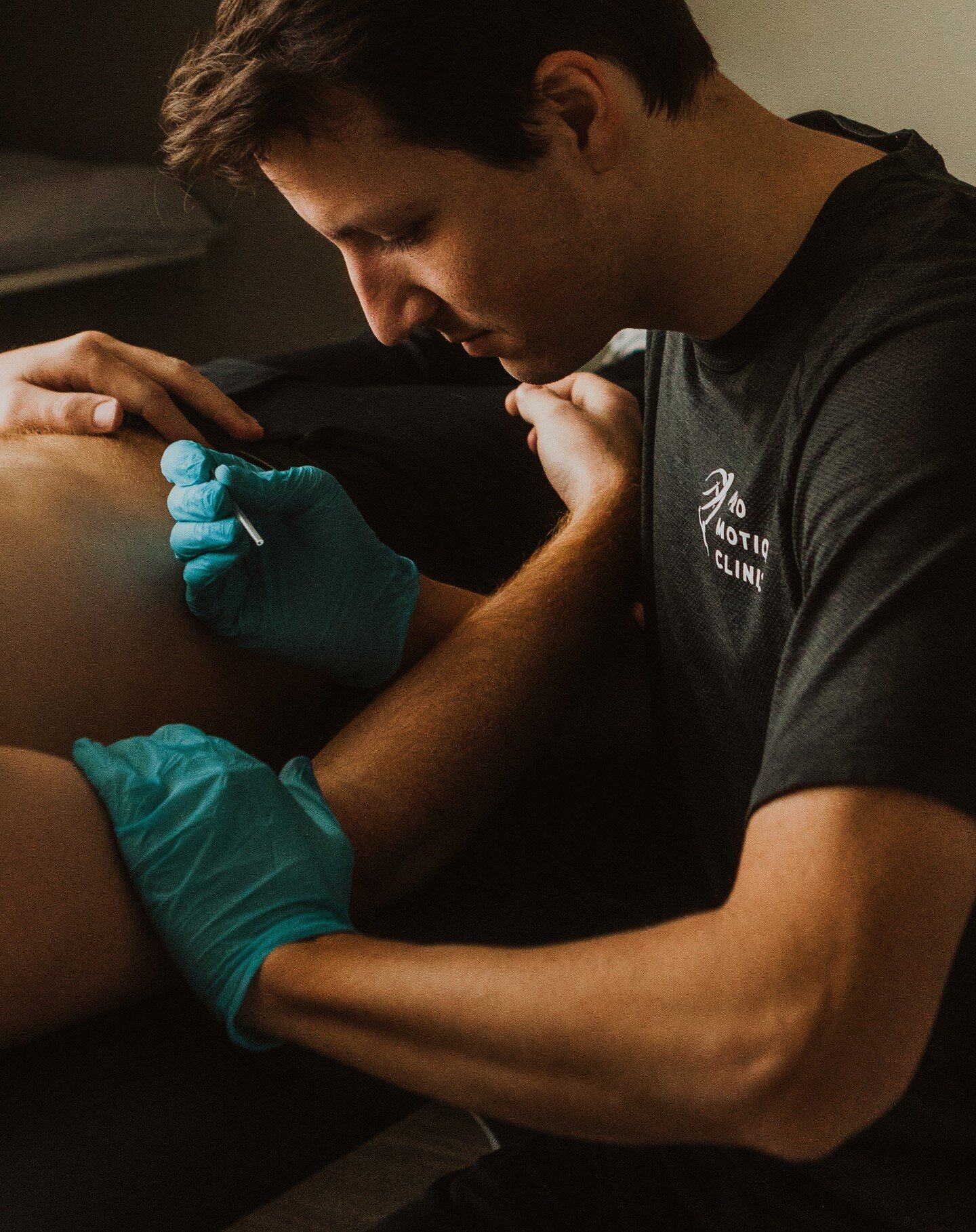 What is dry needling? 

Dry needling is a highly effective treatment modality utilized to alleviate musculoskeletal pain and dysfunction. During a dry needling session, a thin needle is inserted into trigger points or knots in muscles or the tendons,