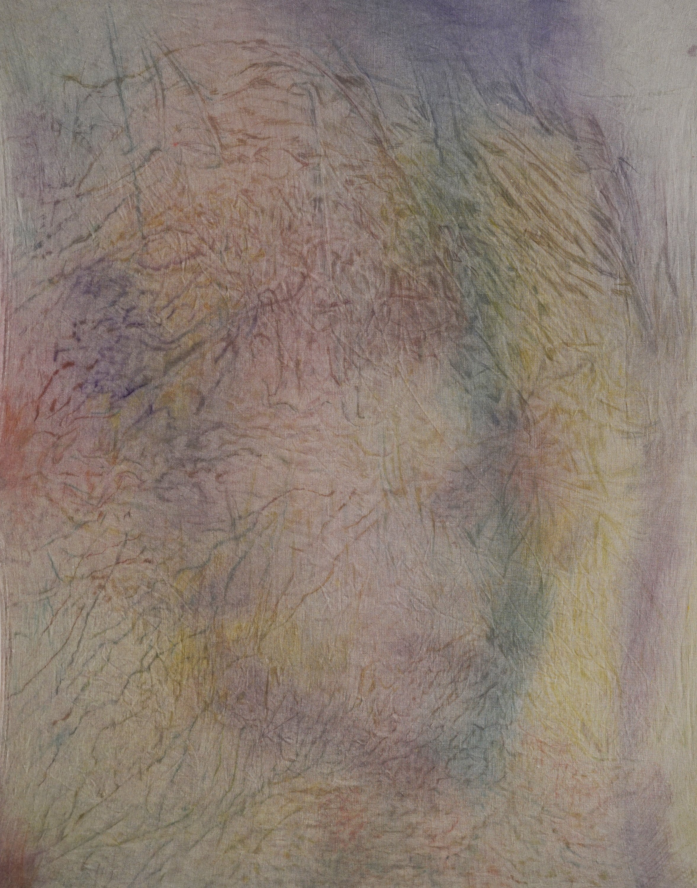 Alina Bliumis Bruise Series #22,249 , 2025. (*Immigration and Customs Enforcement held 47,928 in ICE detention according to data current as of April 6, 2025. 22,249 out of 47,928—or 46.4%—held in ICE detention have no criminal record, according to