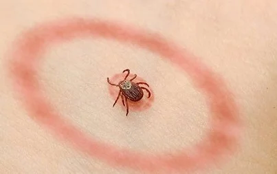 lyme_disease_at_DuckDuckGo.jpg