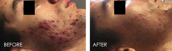 CELLUMA 3.jpg