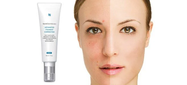 skinceuticals-advanced-pigment-corrector-sld-2237.jpg