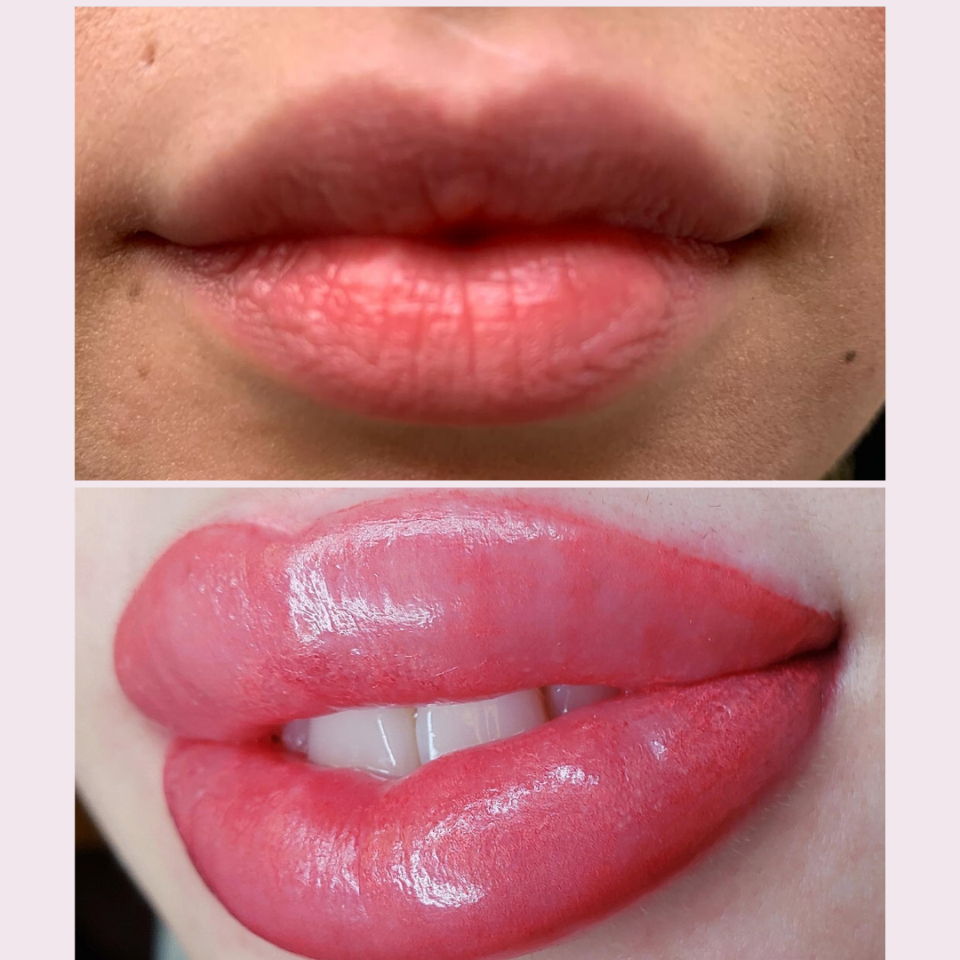 Lip Blushing Rejuva Medi Spa Lip Blushing Rejuva Medi Spa