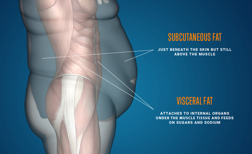 Visceral fat and Subqutaneous fat.png