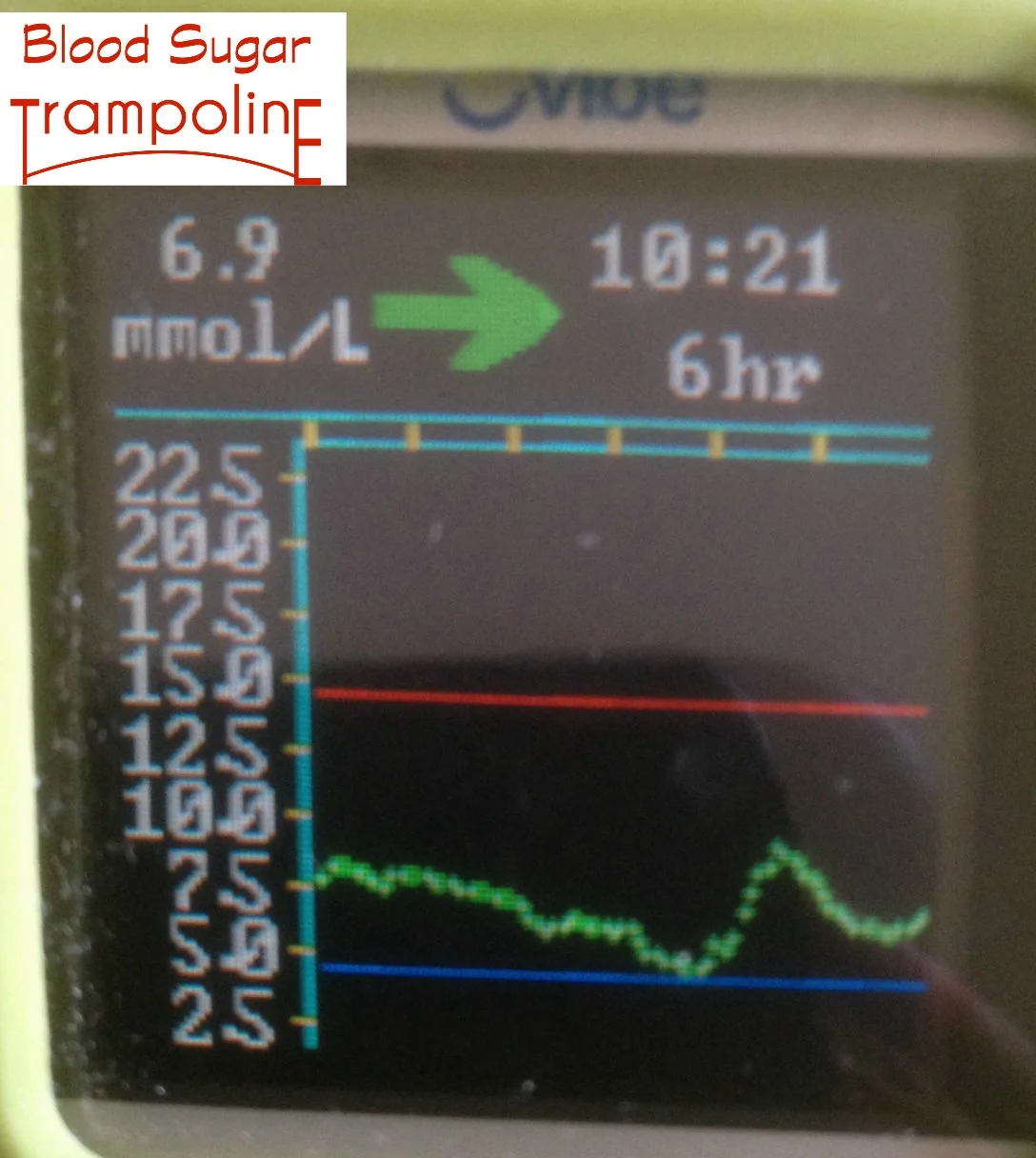 Things I've Learned about My Diabetes with a CGM