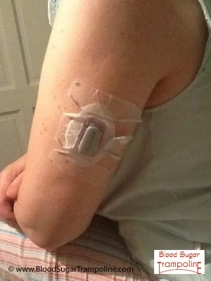 Short Sleeves and Stares