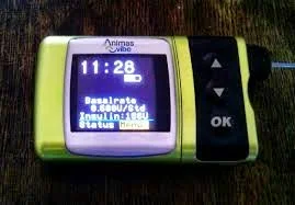 Insulin Pump - What is it like to wear one?