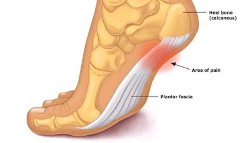 Inside Sole Heel Pain My Ankle Inner Heel Pain After Running The