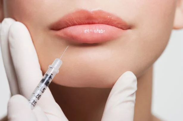 dermal fillers lips.jpg