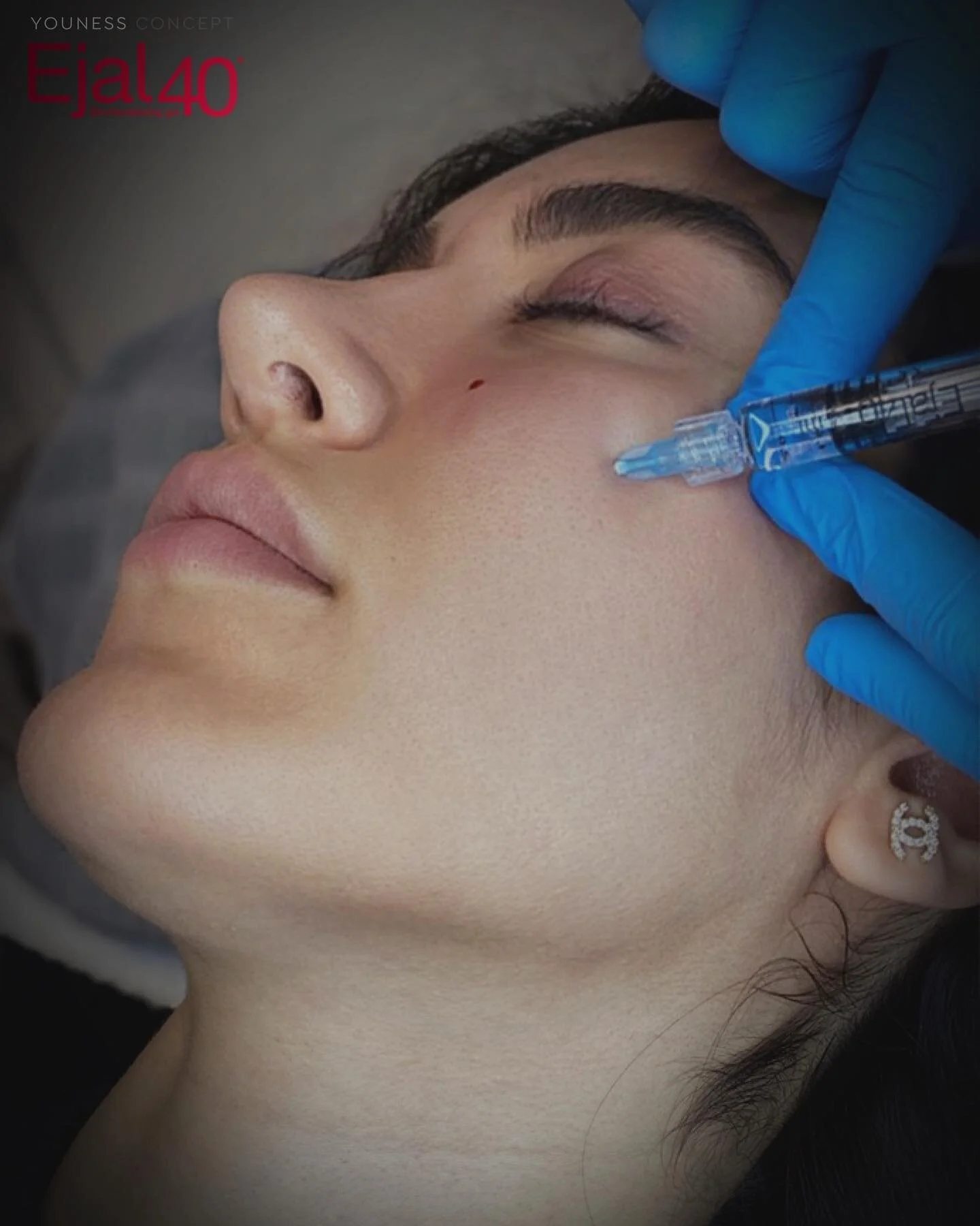 Just nu erbjuder vi paketpris p&aring; en lyxig ansiktsbehandling hos v&aring;r auktoriserade hudterapeut @noursqin och efter&aring;t en behandling med salongens mest popul&auml;ra skinbooster! Det &auml;r den ultimata kombinationen f&ouml;r en frisk