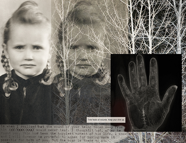The Scar Remains