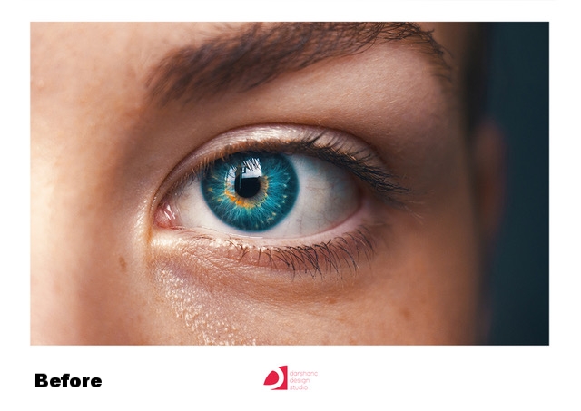 eye before.jpeg