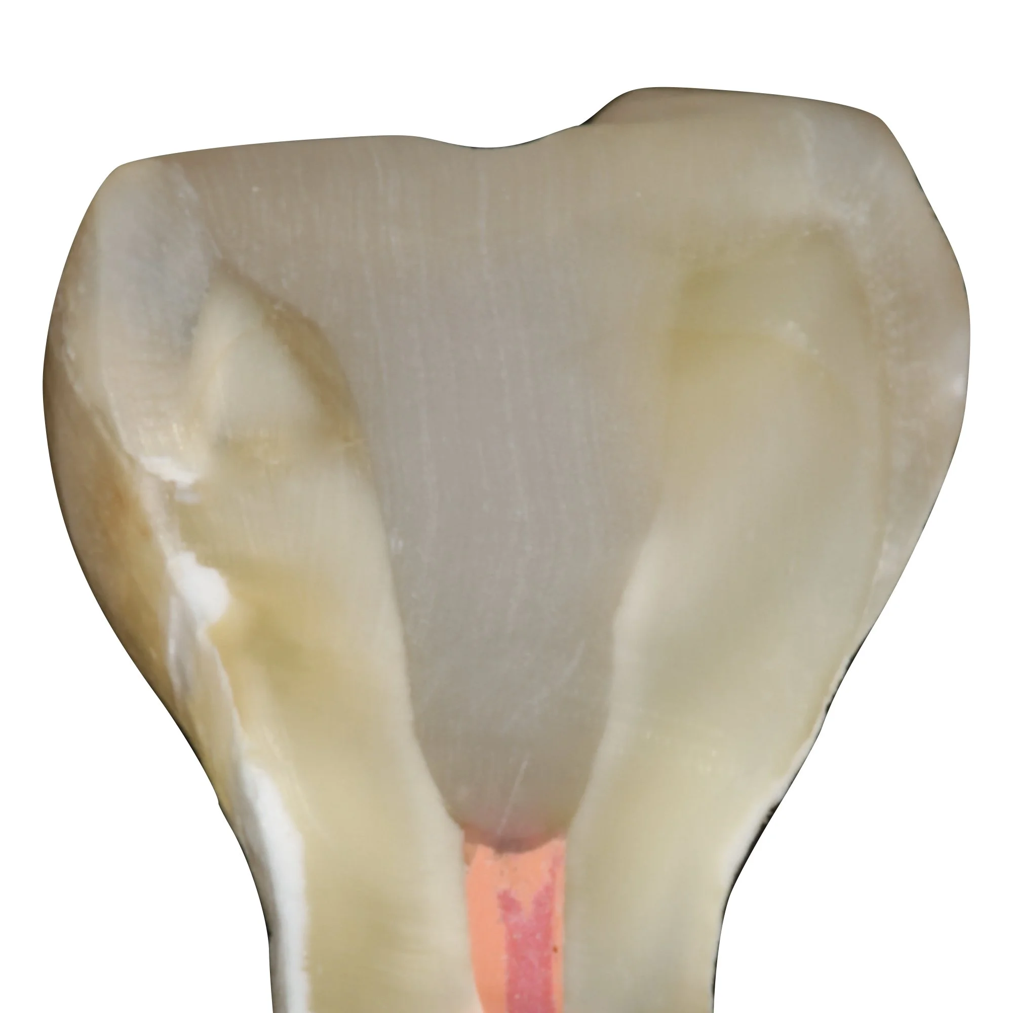 composite-dental-anterior-posterior-bonding-course.009.jpeg