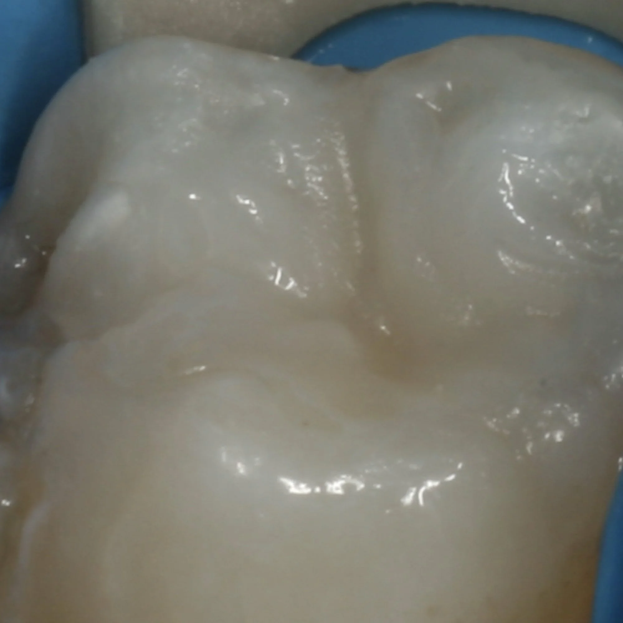 composite-dental-anterior-posterior-bonding-course.013.jpeg