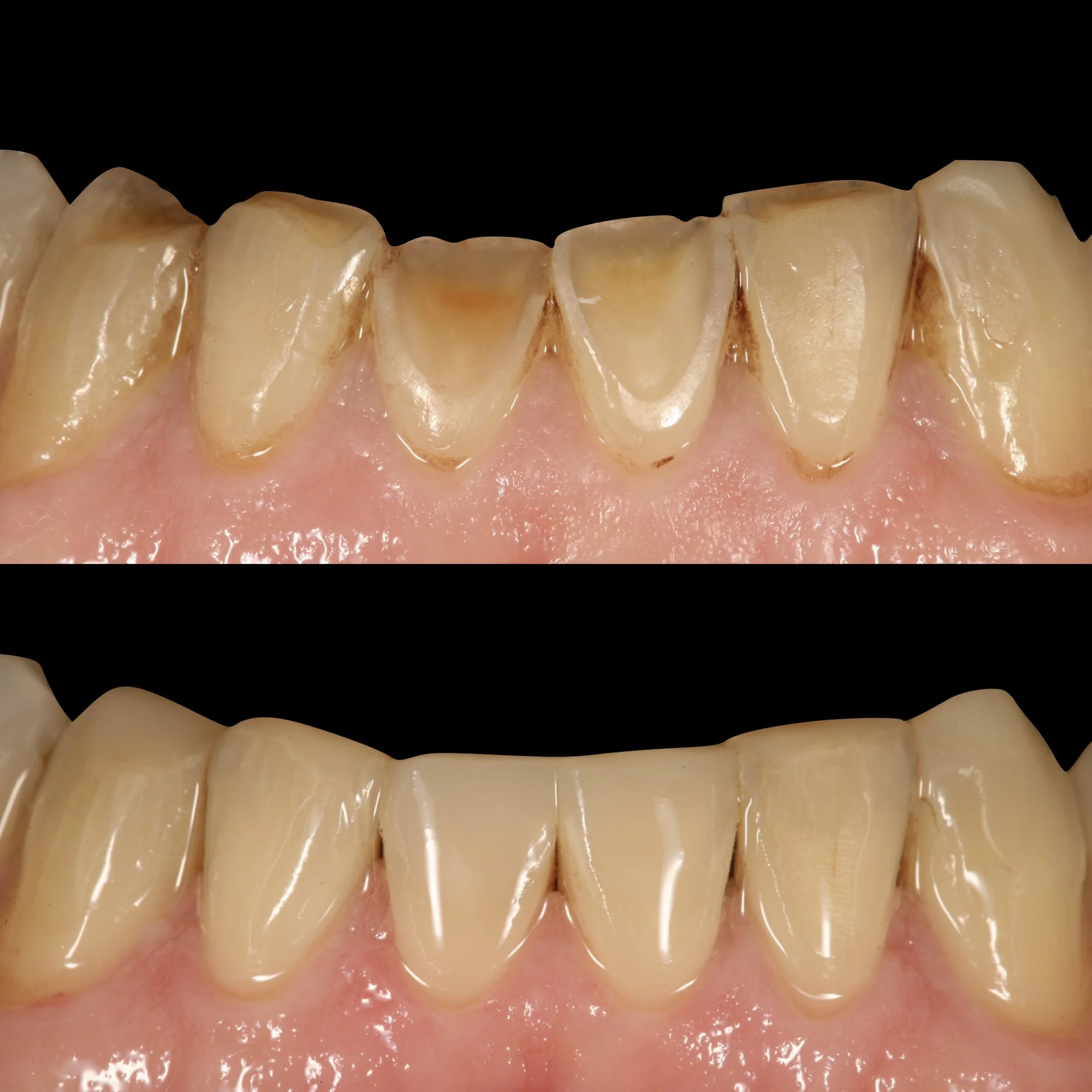 composite-dental-anterior-posterior-bonding-course.004.jpeg