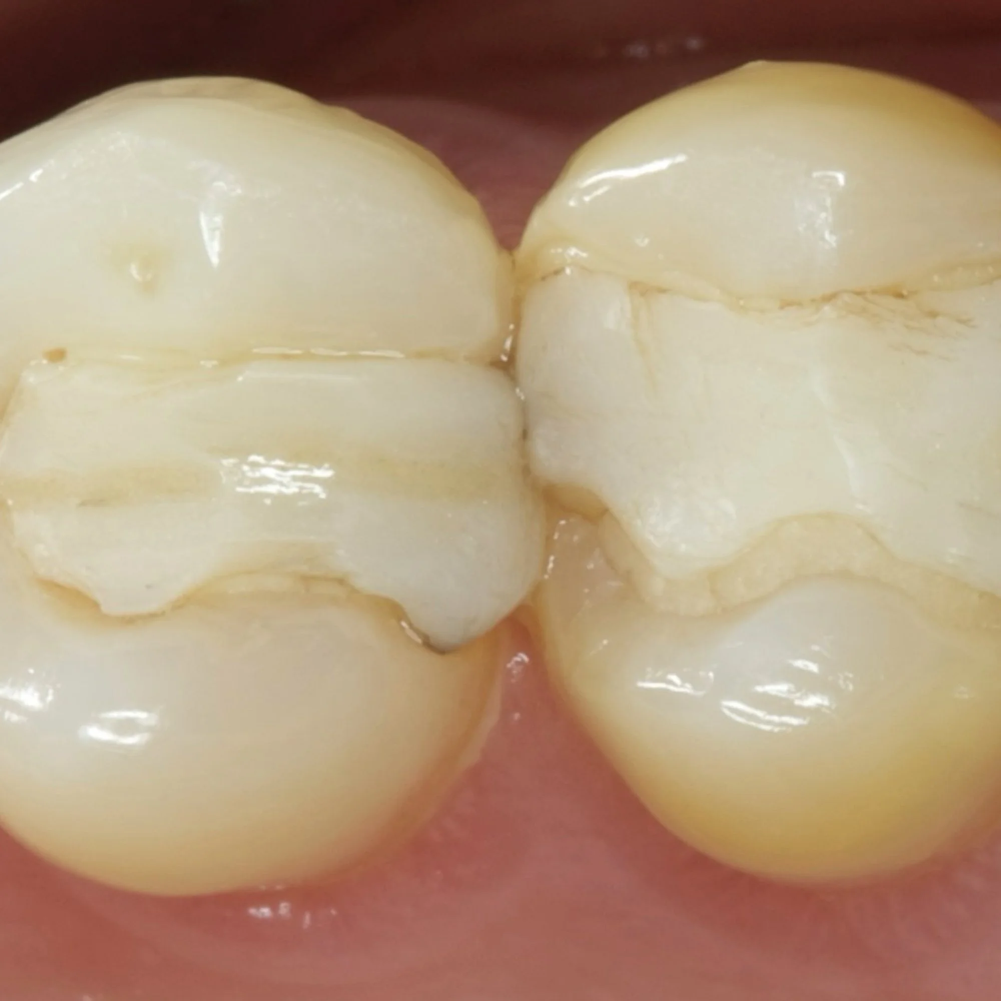 composite-dental-anterior-posterior-bonding-course.010.jpeg