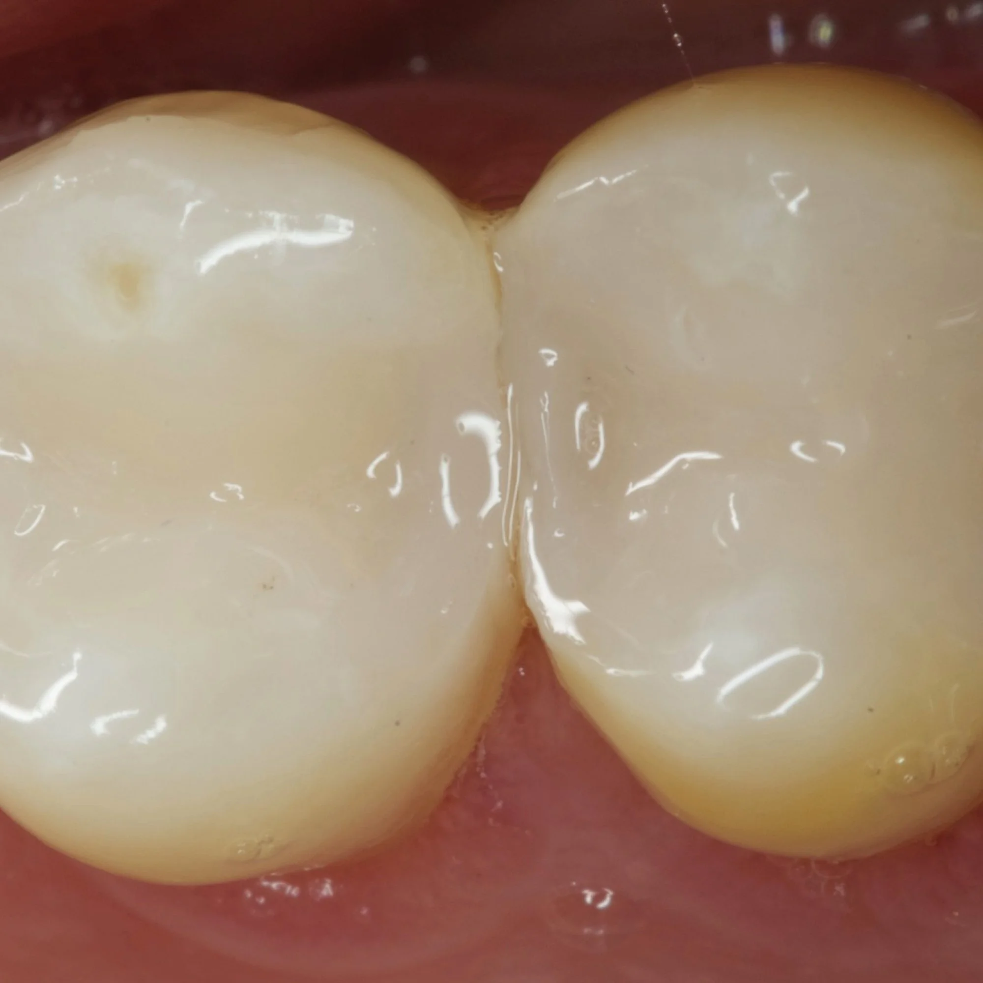 composite-dental-anterior-posterior-bonding-course.011.jpeg