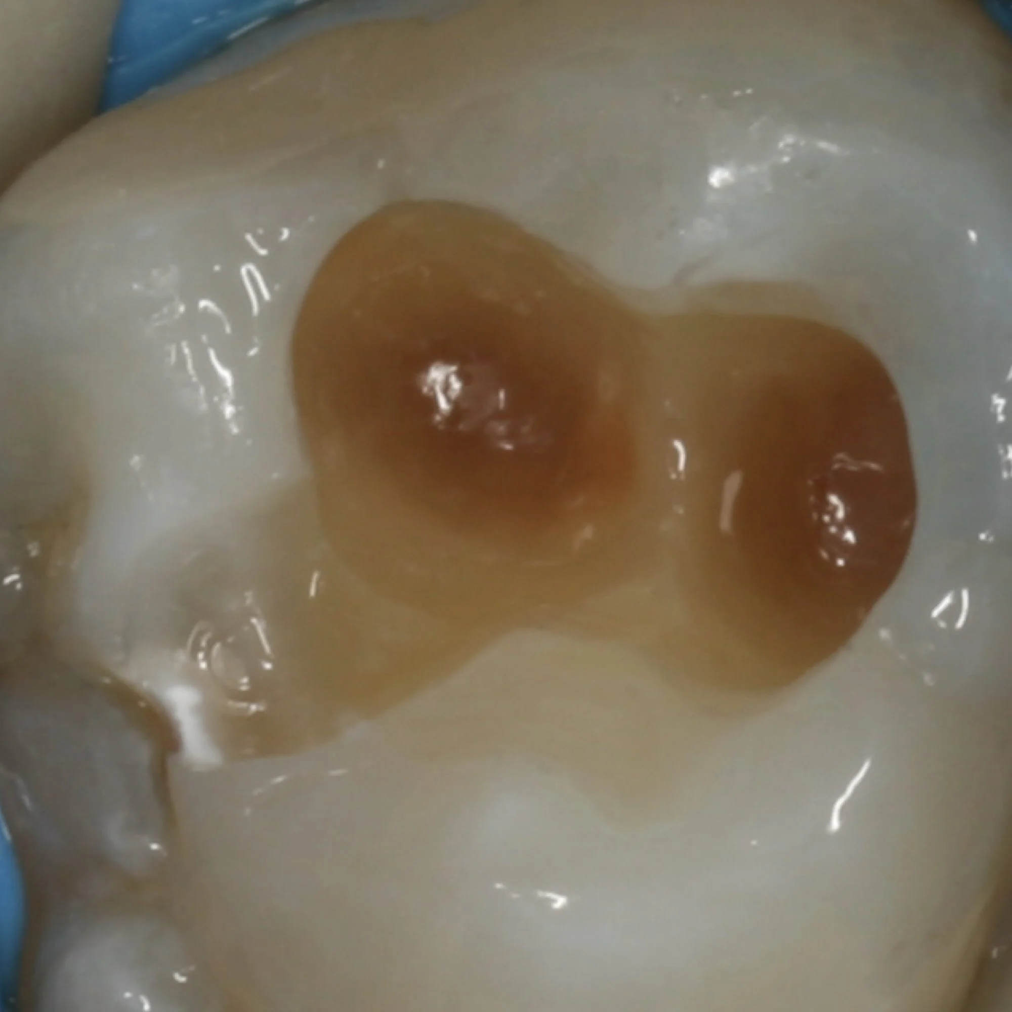 composite-dental-anterior-posterior-bonding-course.012.jpeg