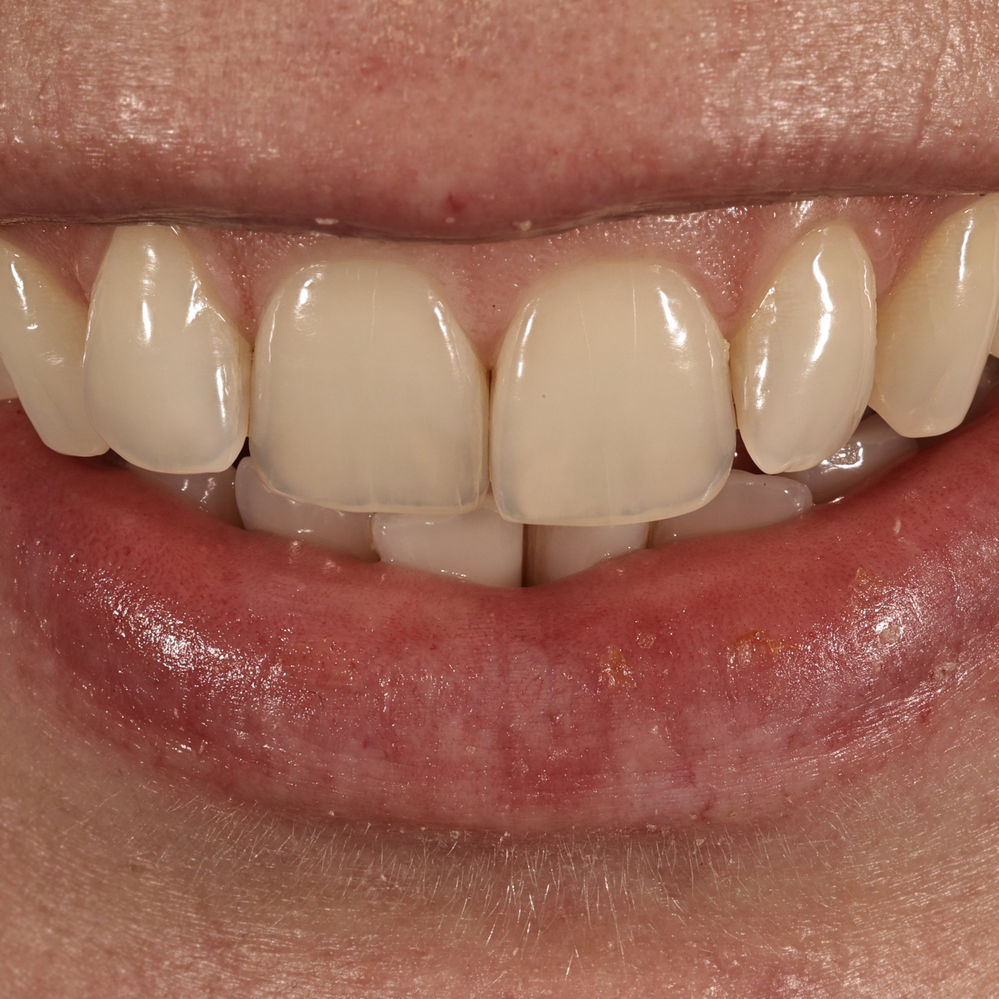 dentalphotoimages.015.jpeg