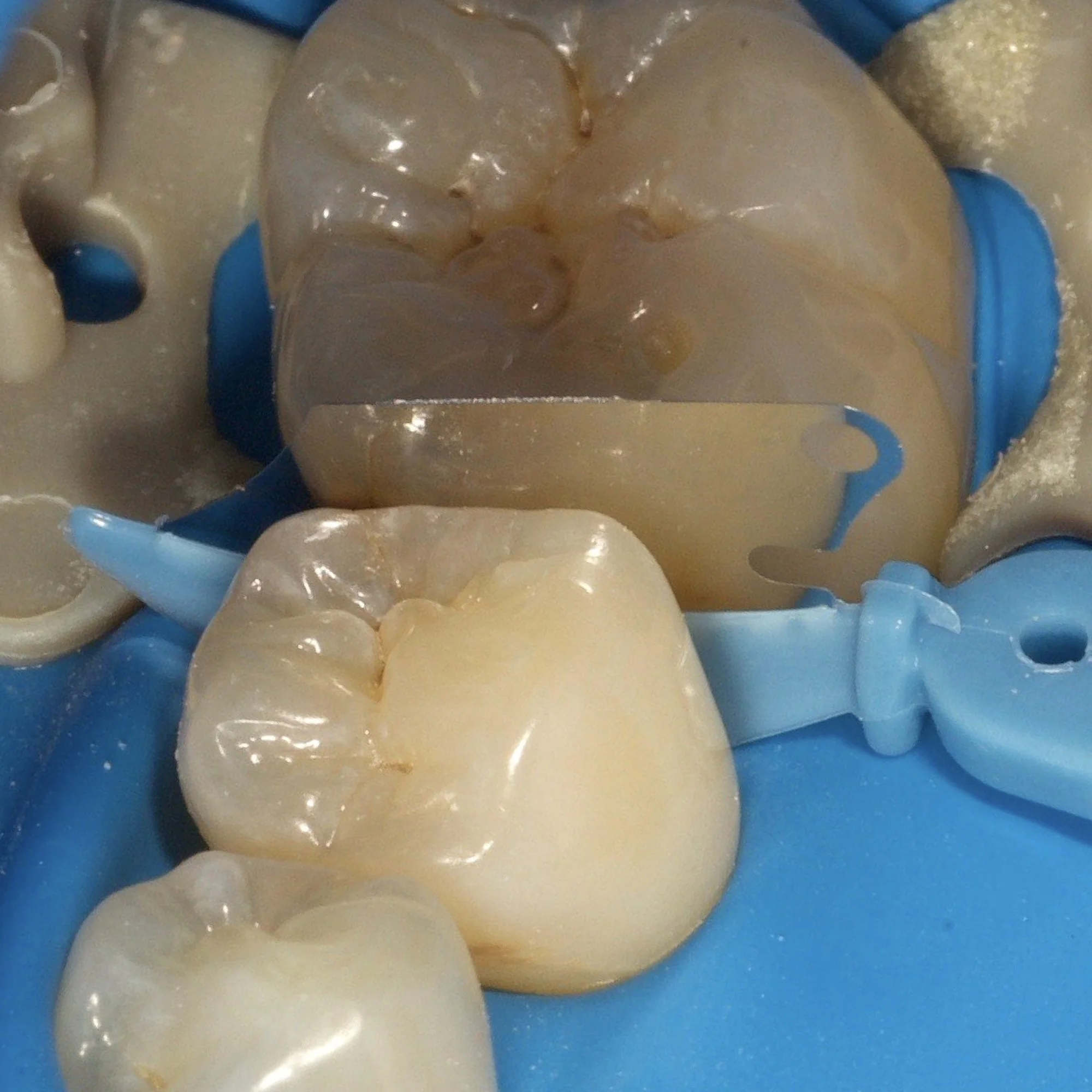 composite-dental-anterior-posterior-bonding-course.008.jpeg