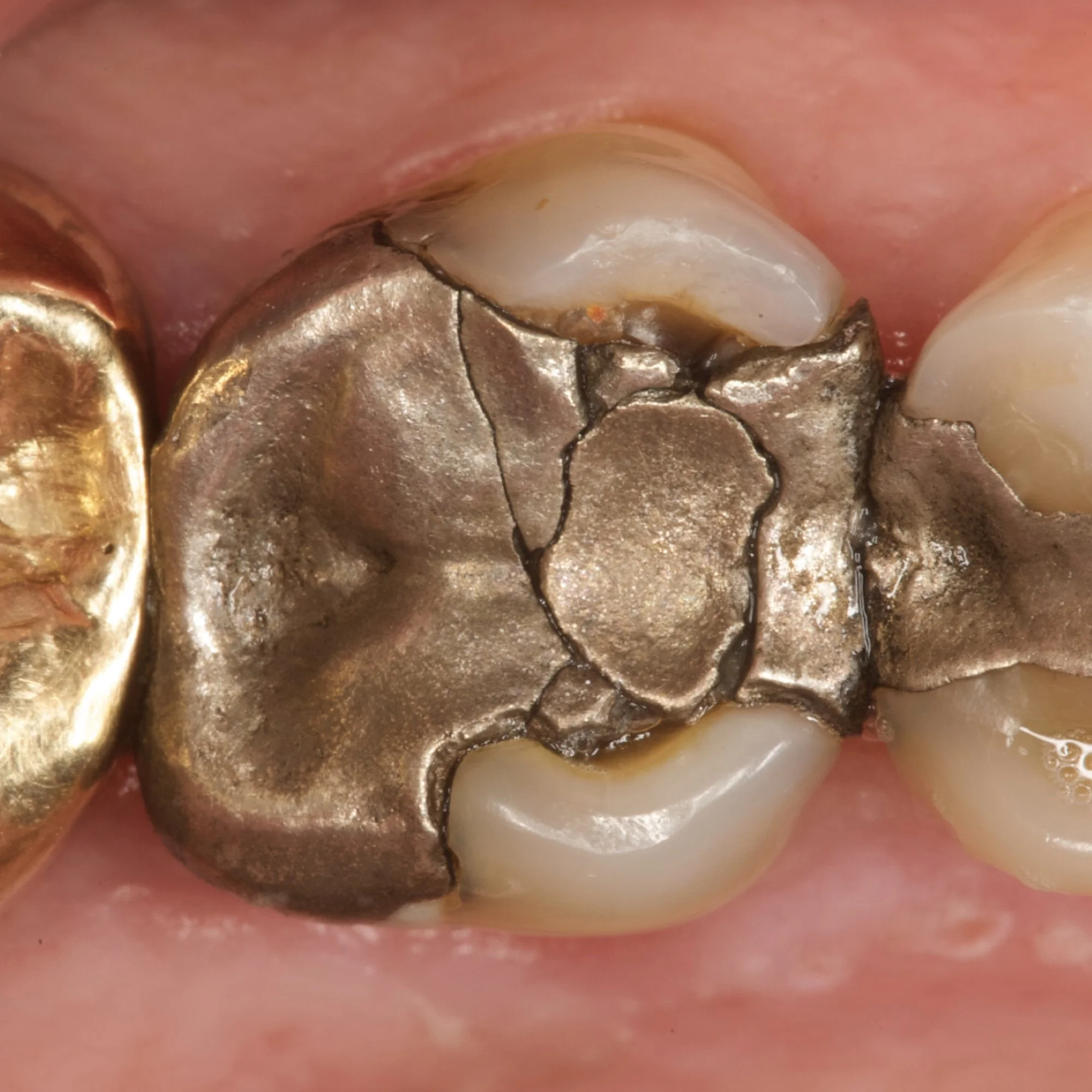 composite-dental-anterior-posterior-bonding-course.006.jpeg