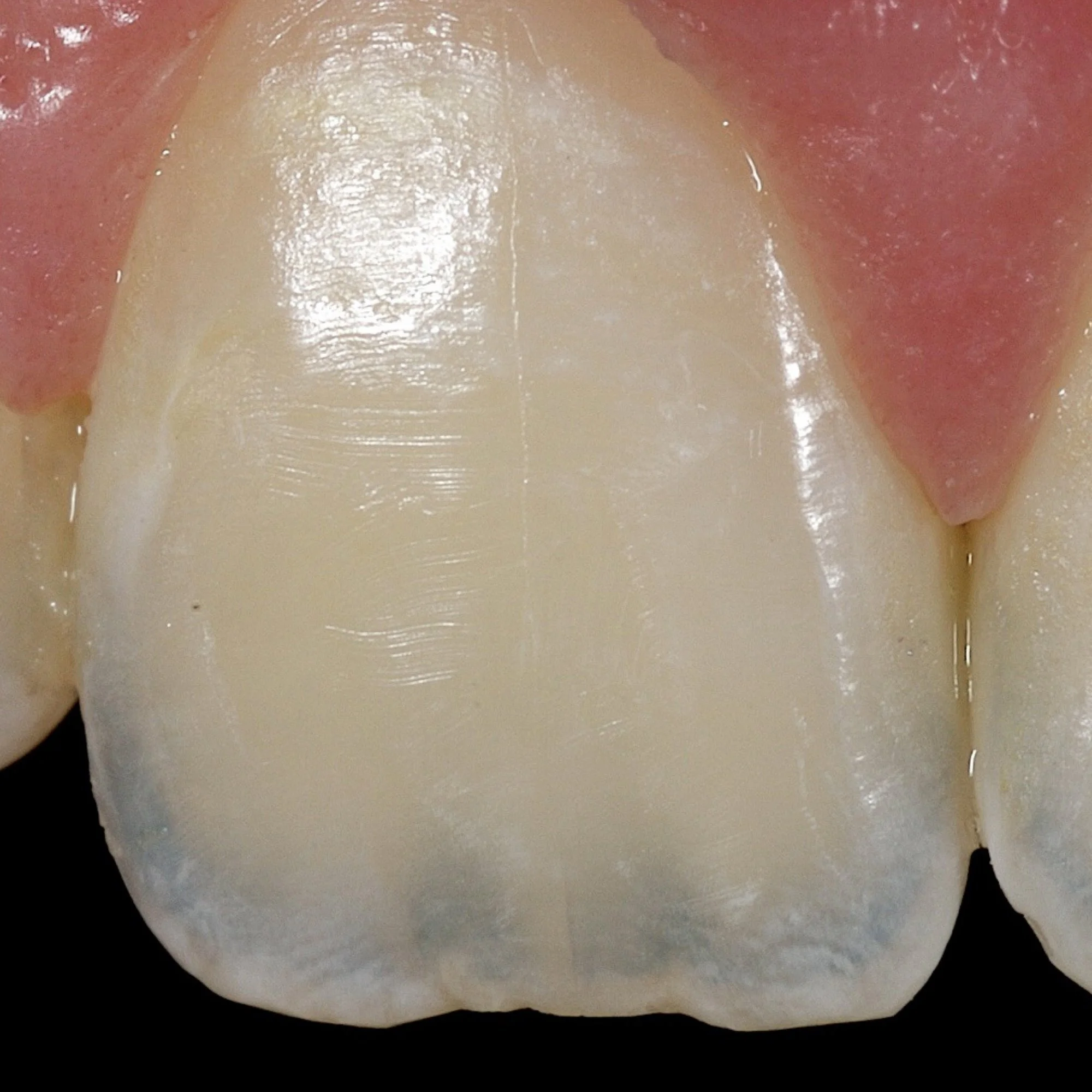 dentalphotoimages.002.jpeg