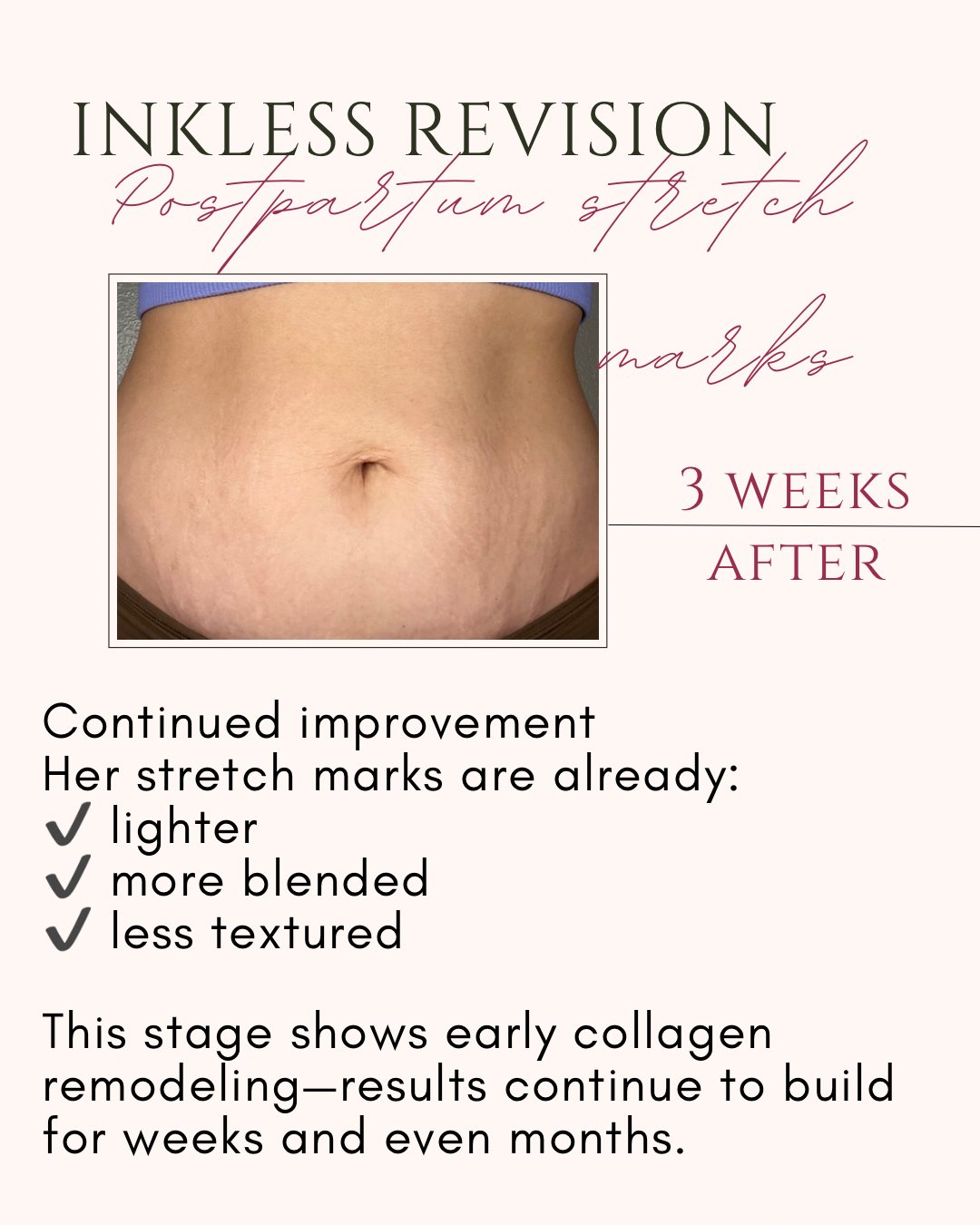 Inkless revision_1.PNG