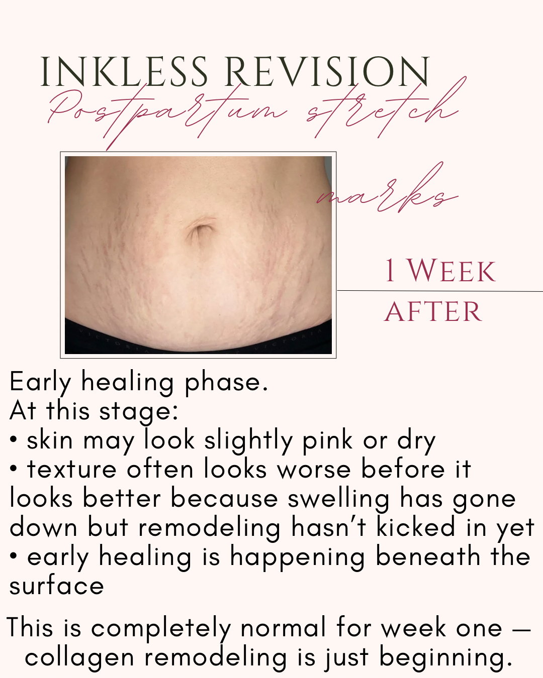 Inkless revision.PNG