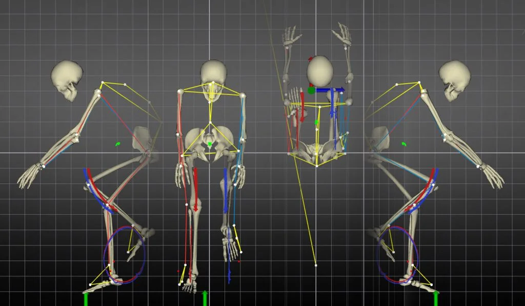 Why is a bike fit important?