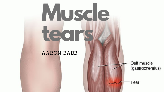 Tear me another one - muscle tears and middle age soccer