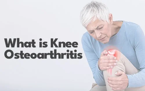 What Is Knee Osteoarthritis &amp; How Can Aevum Health Help?