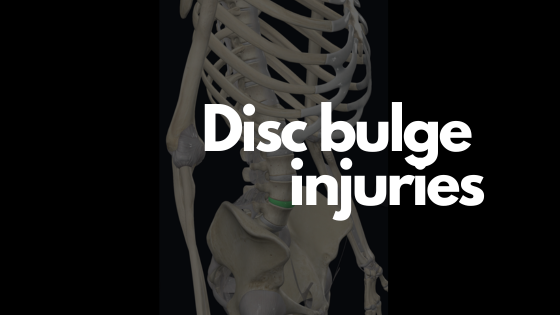 Lumbar Disc Bulge: Understanding the Condition and the Benefits of Physiotherapy
