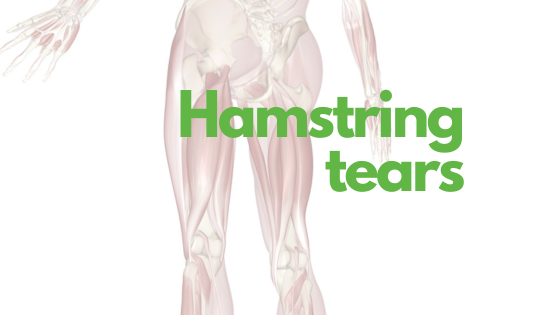 Understanding and Managing Hamstring Muscle Injuries