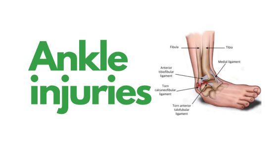 Ankle injuries in football and how to prevent them
