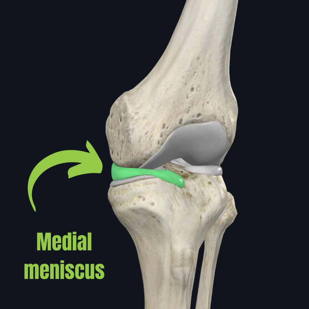 What is a Knee Meniscal Tear and Can Physiotherapy Help? — Aevum