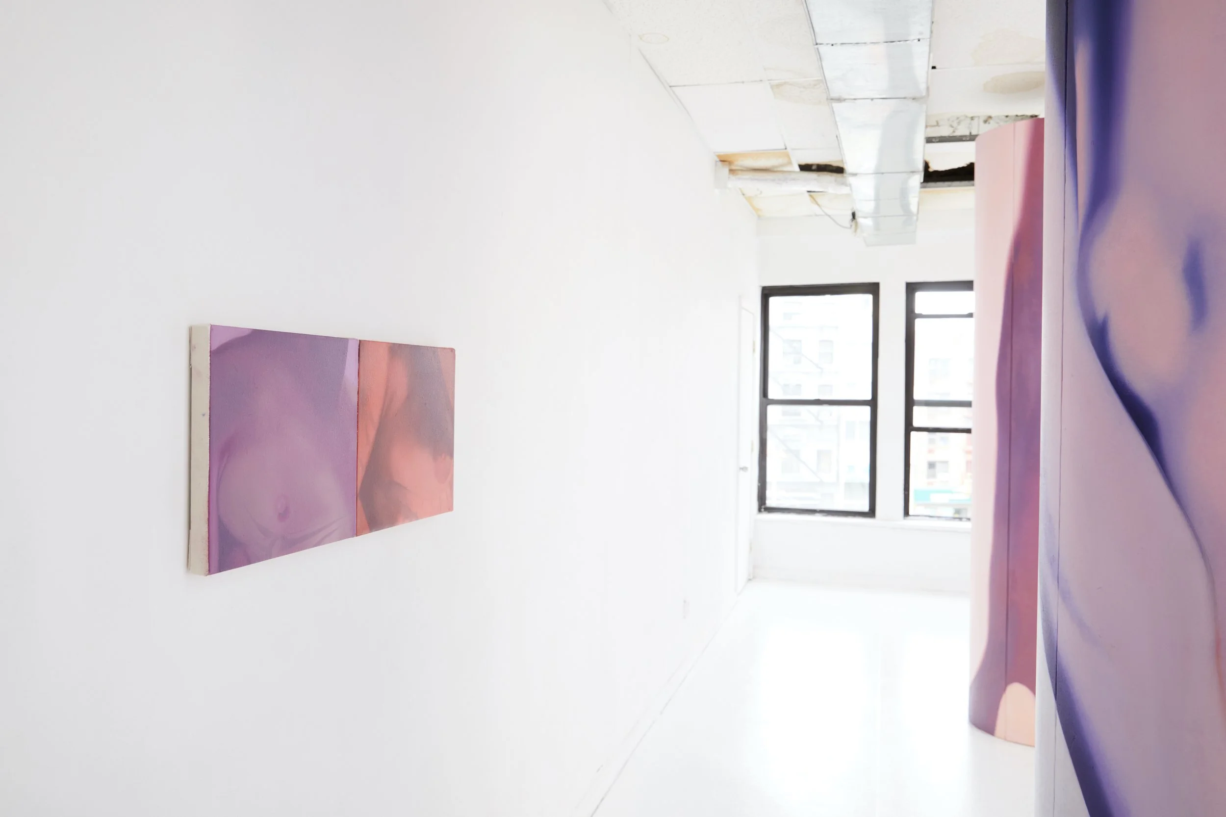  Installation view. 