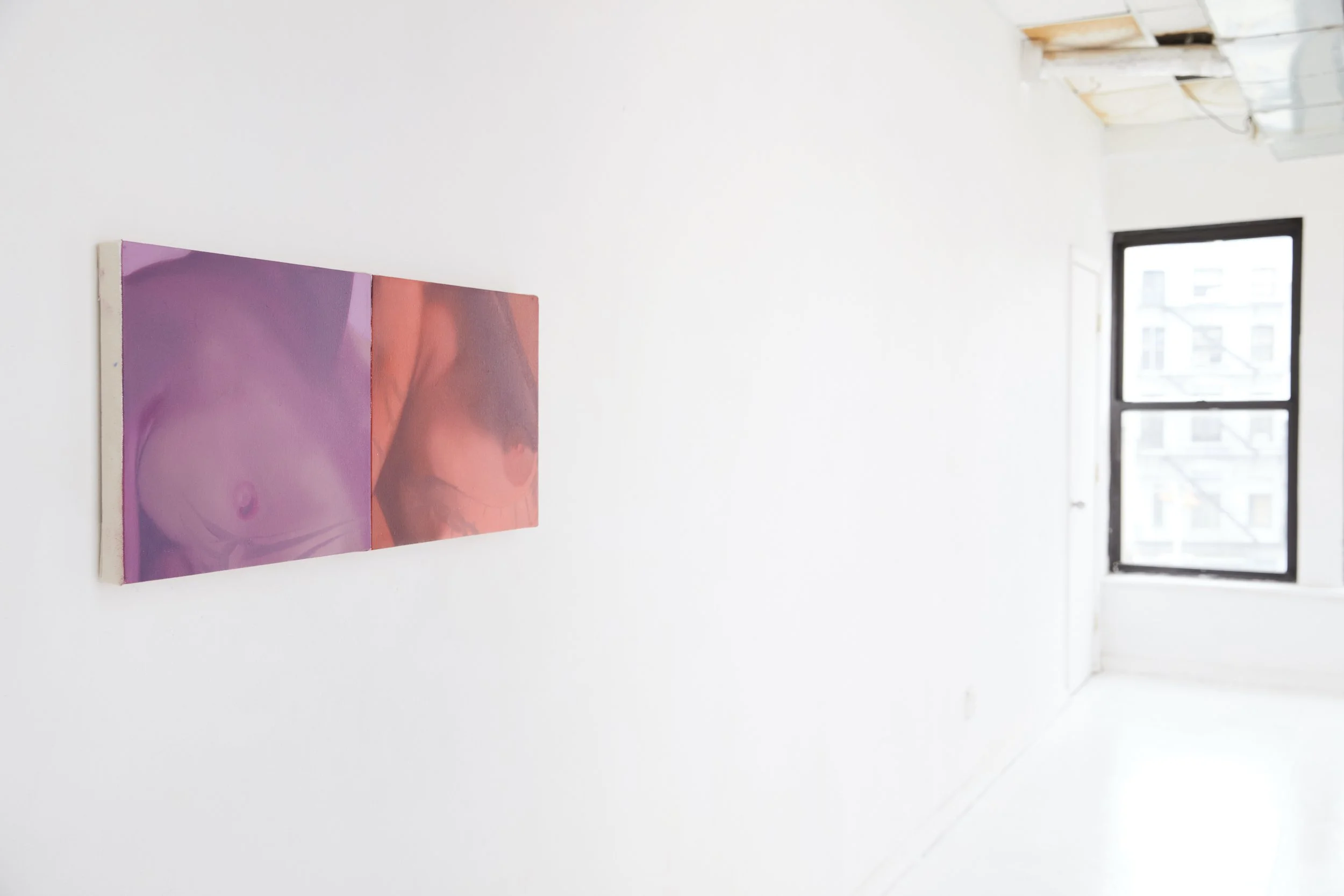  Installation view. 
