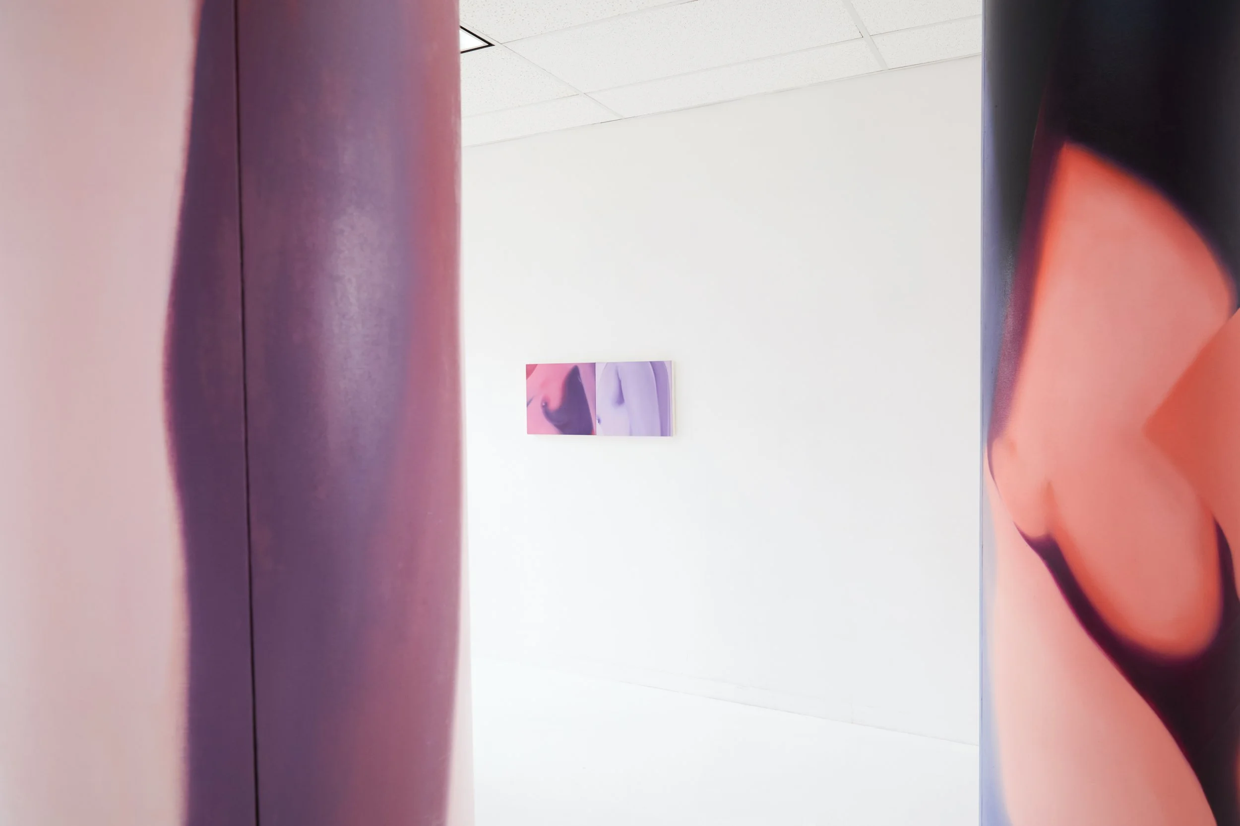  Installation view. 