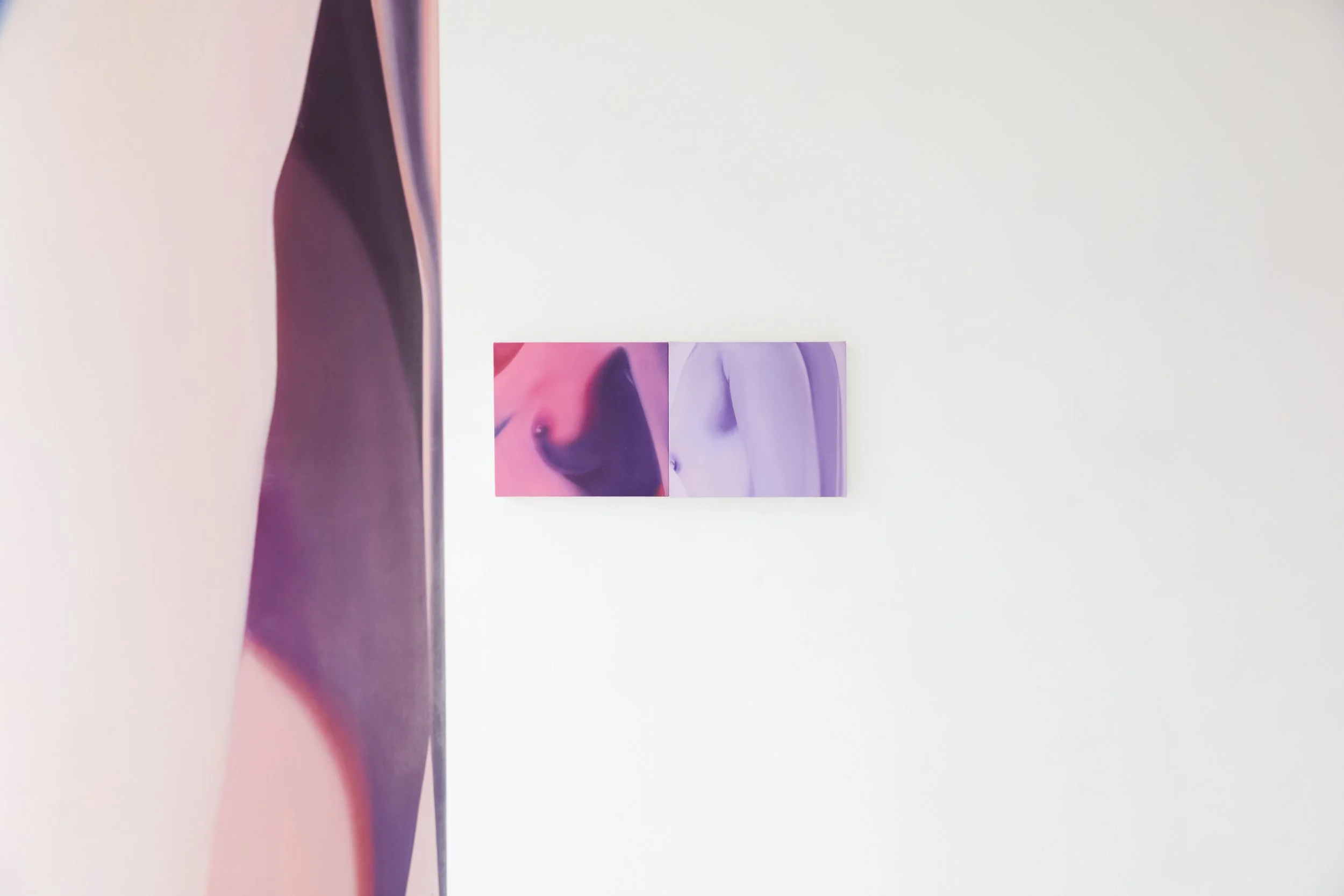 Installation view. 