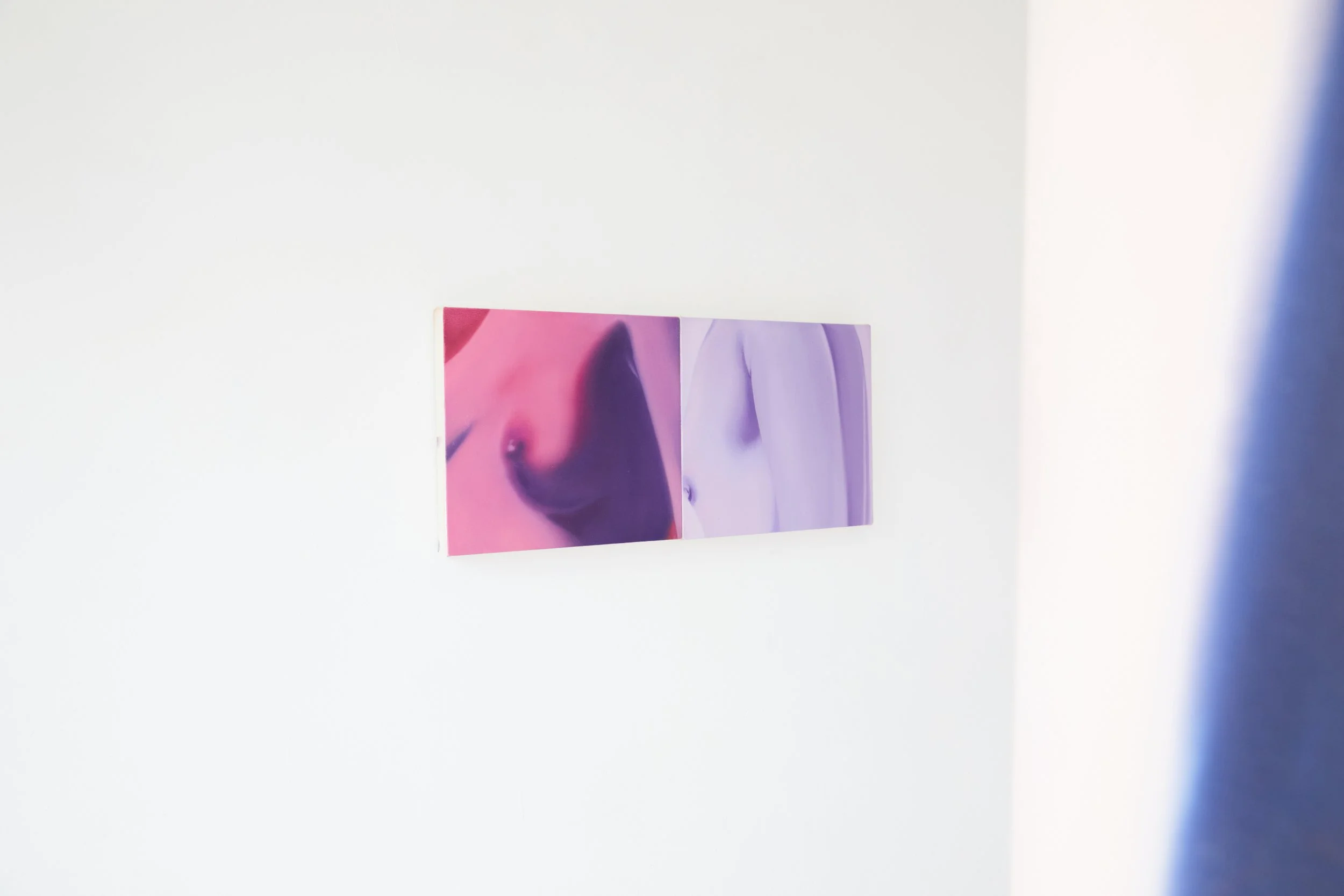  Installation view. 