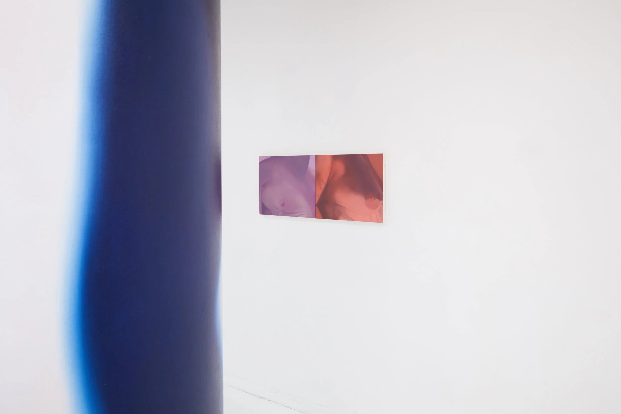 Installation view. 