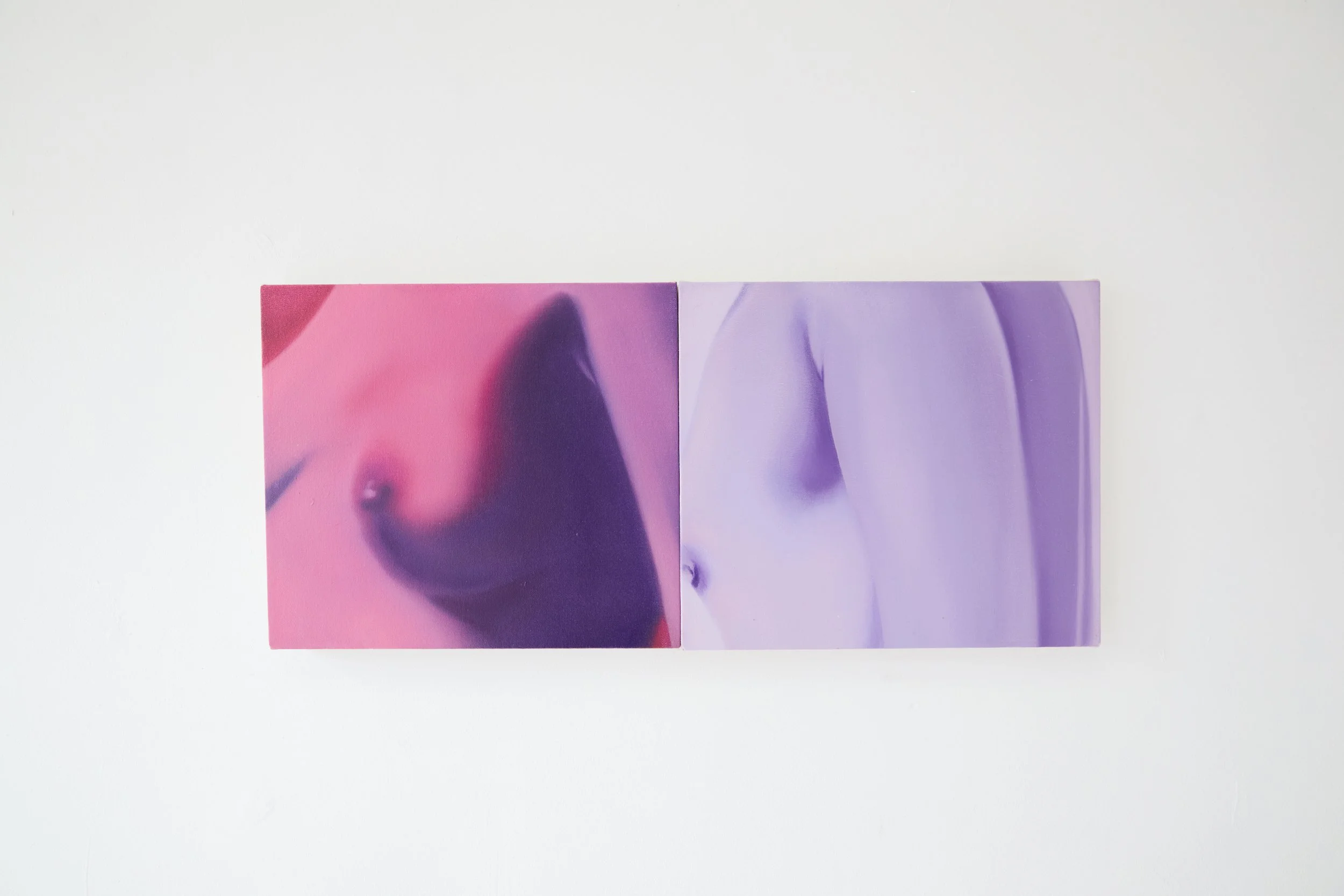  Installation view. 