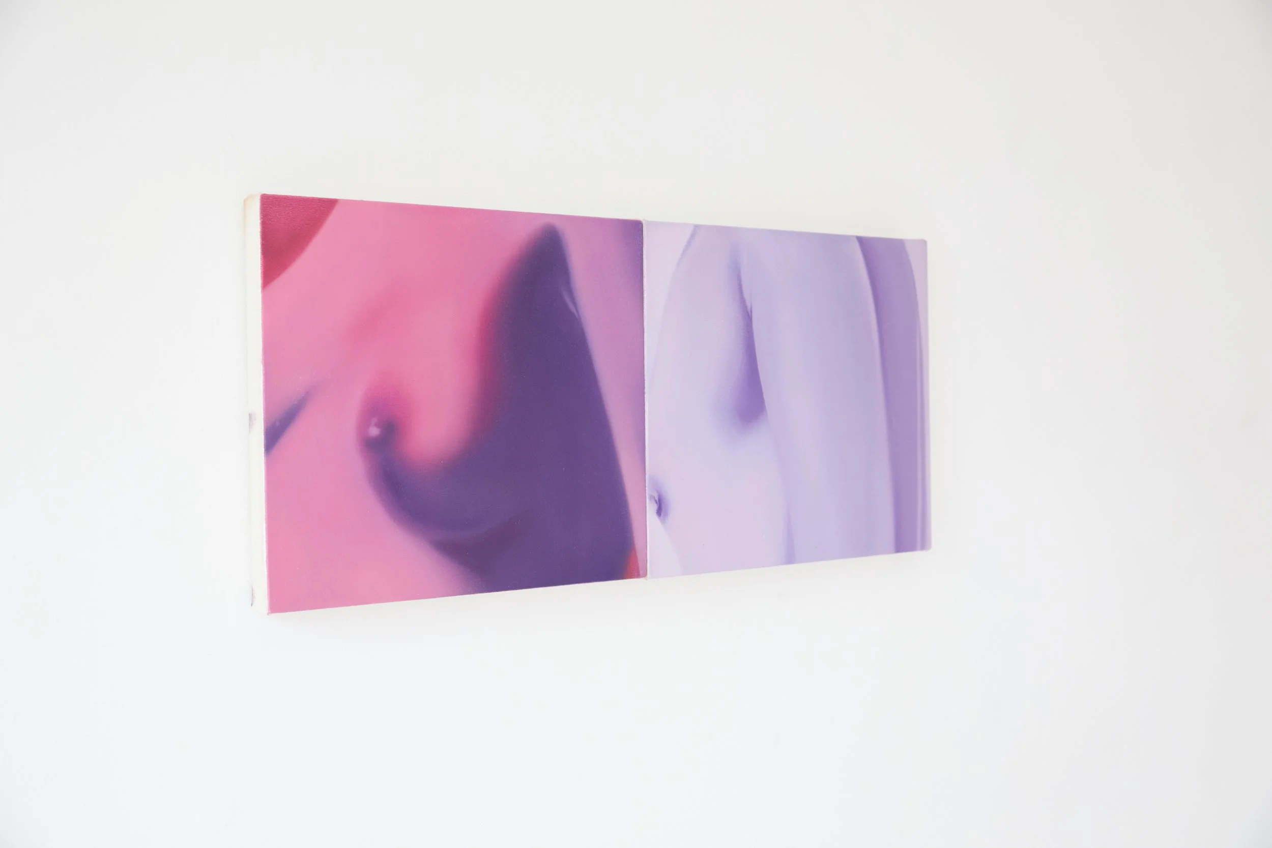  Installation view. 