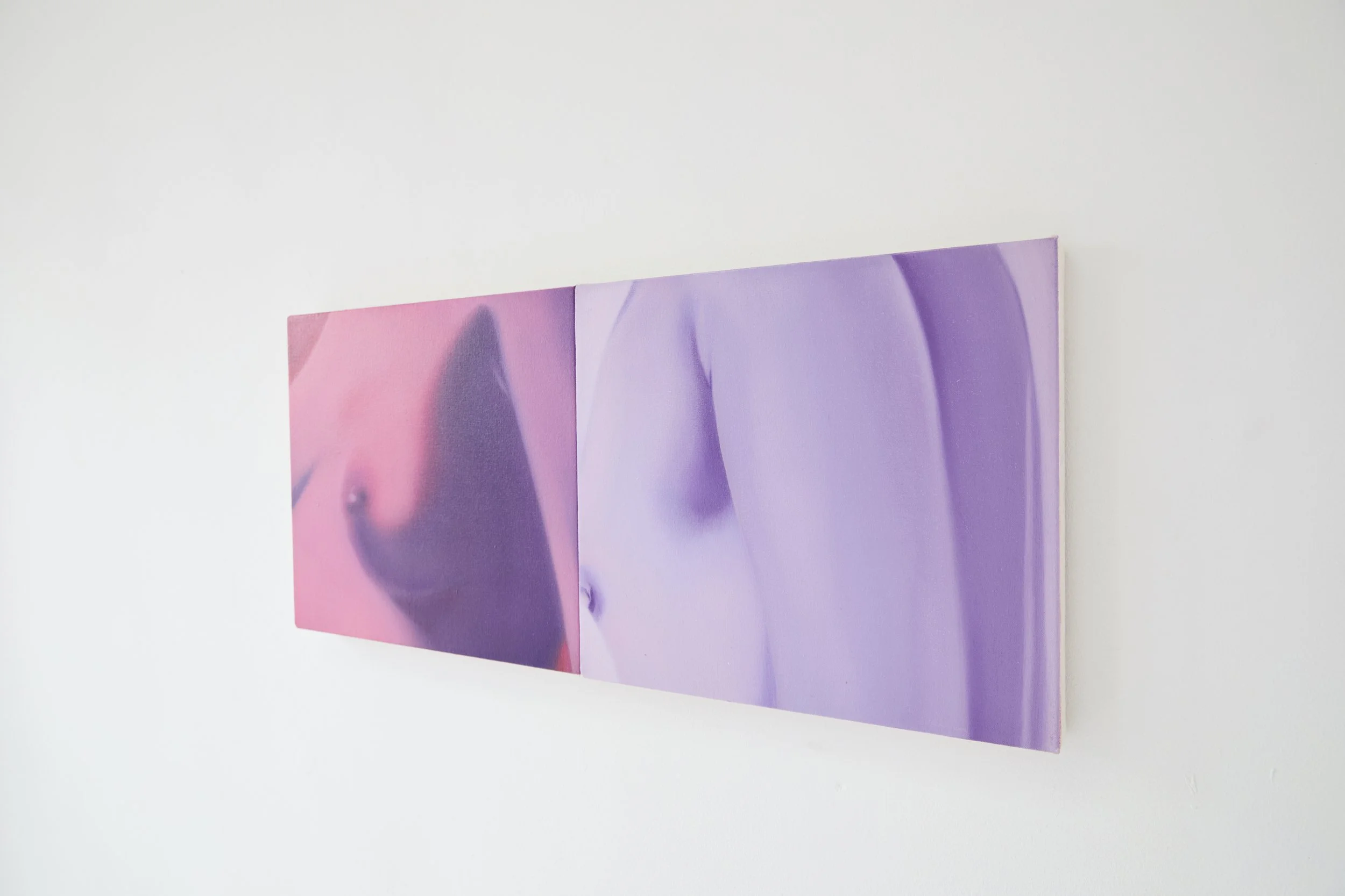  Installation view. 